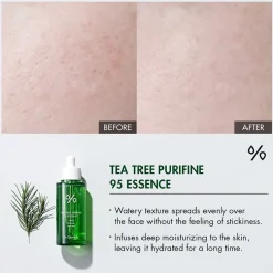 Tea Tree Purifine 95 Essence